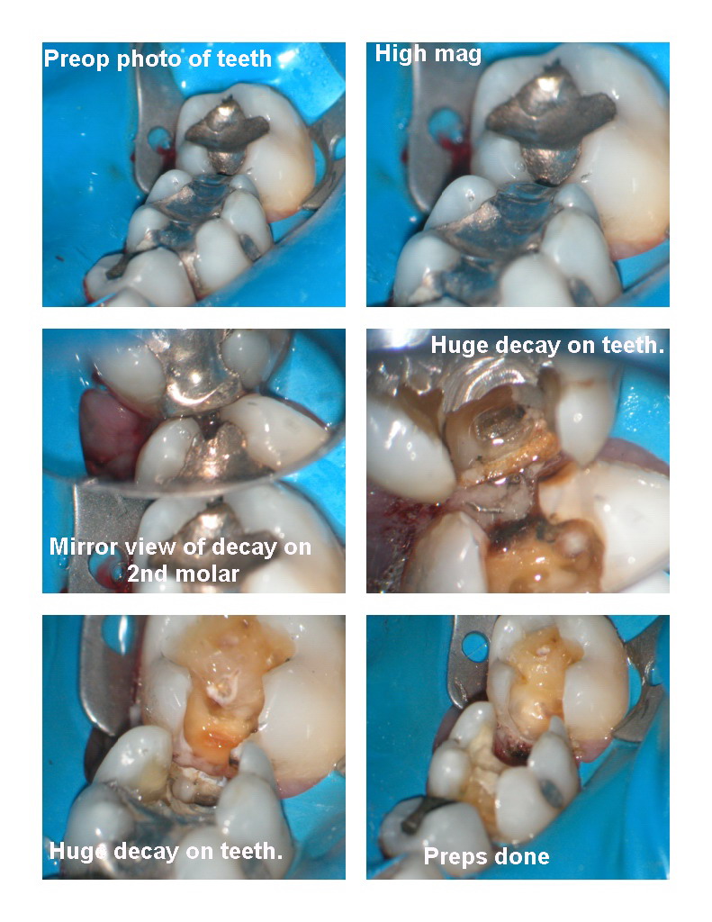 Deep Cavities pg 1.jpg